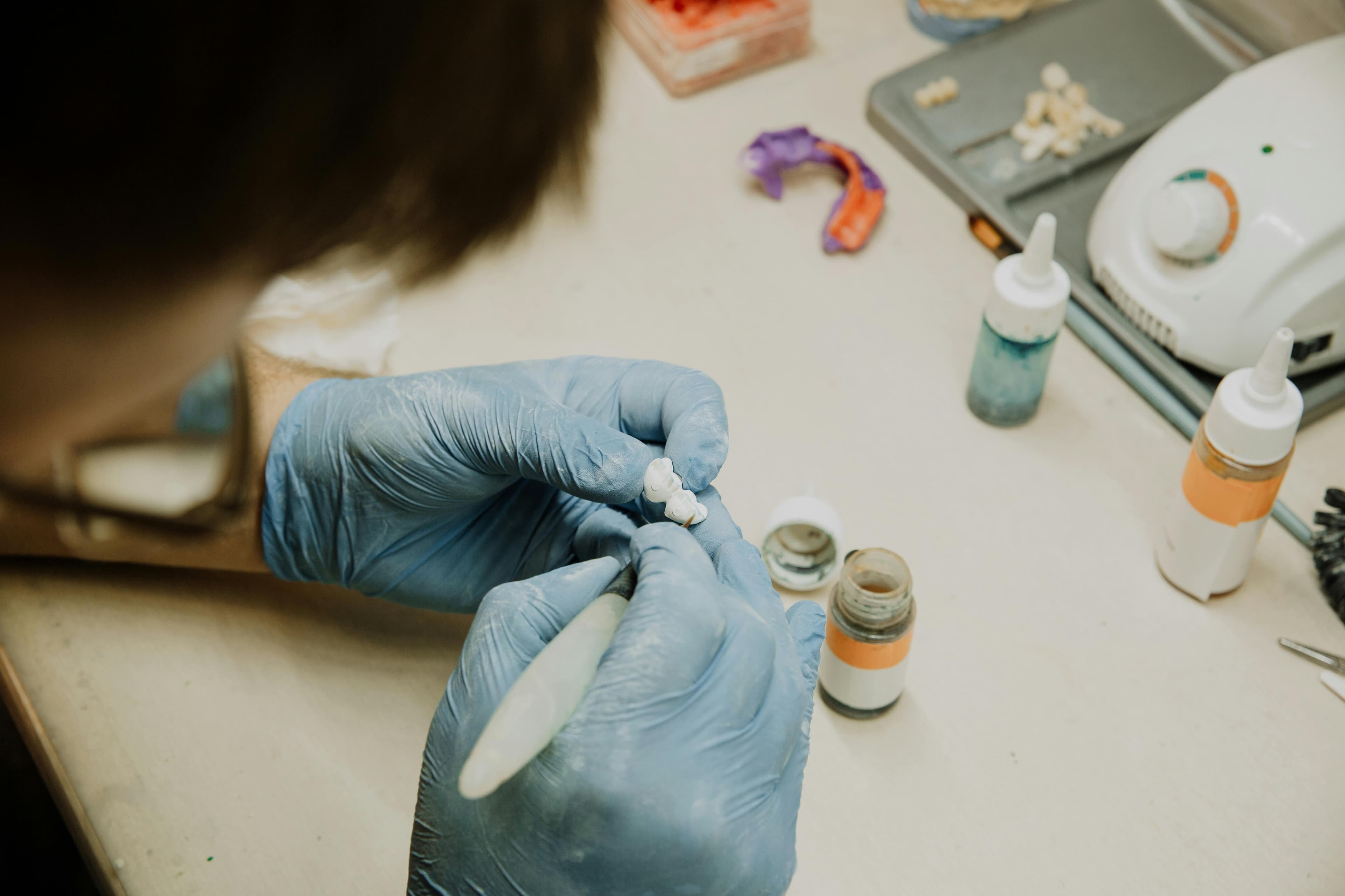 Signs it may be time to consider dental implants