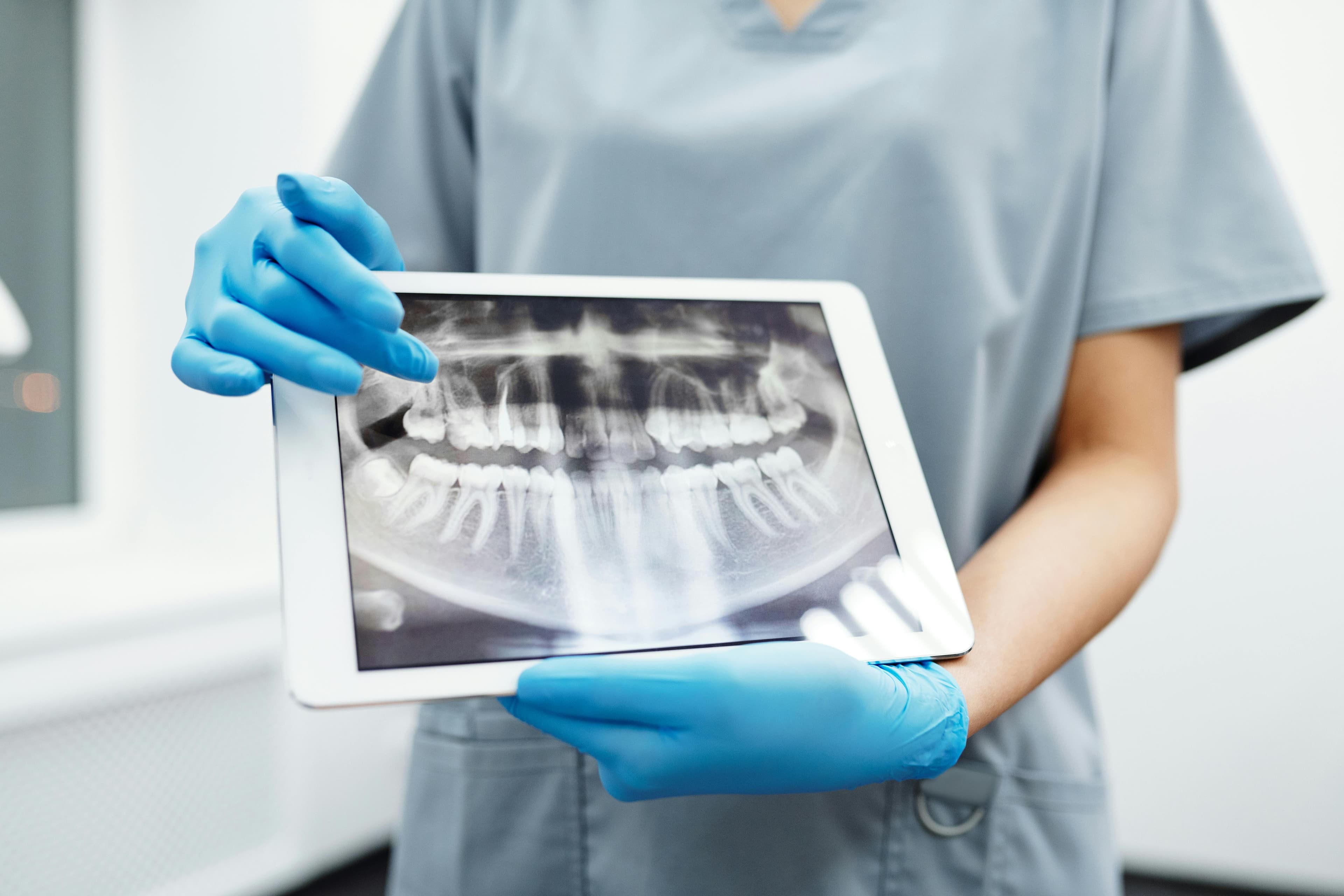 When a root canal may be the right treatment