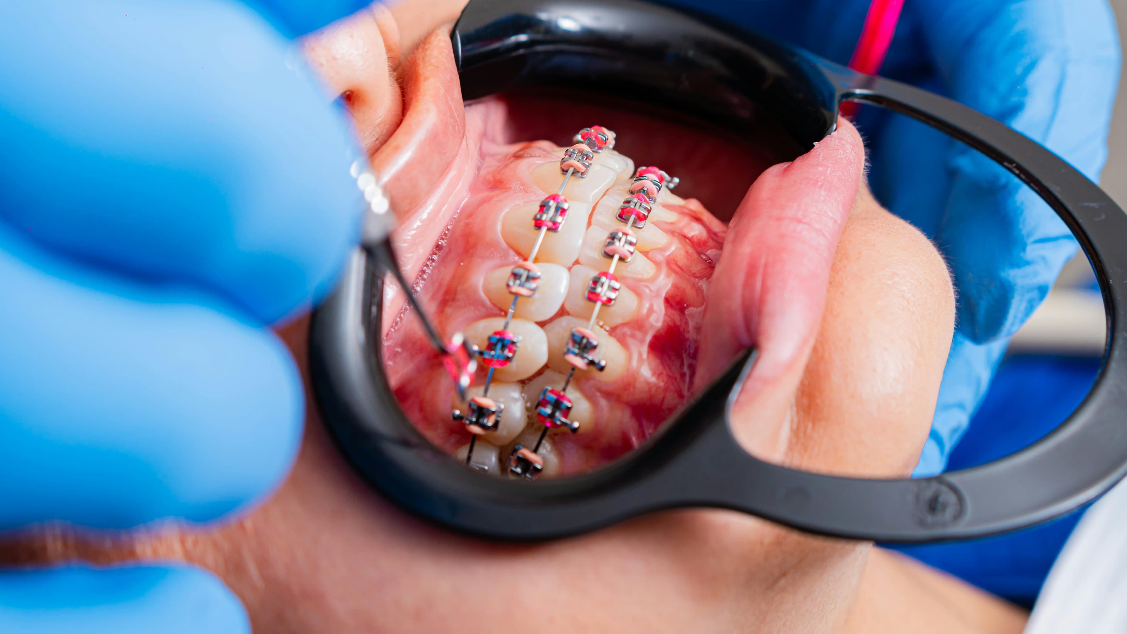 Orthodontics