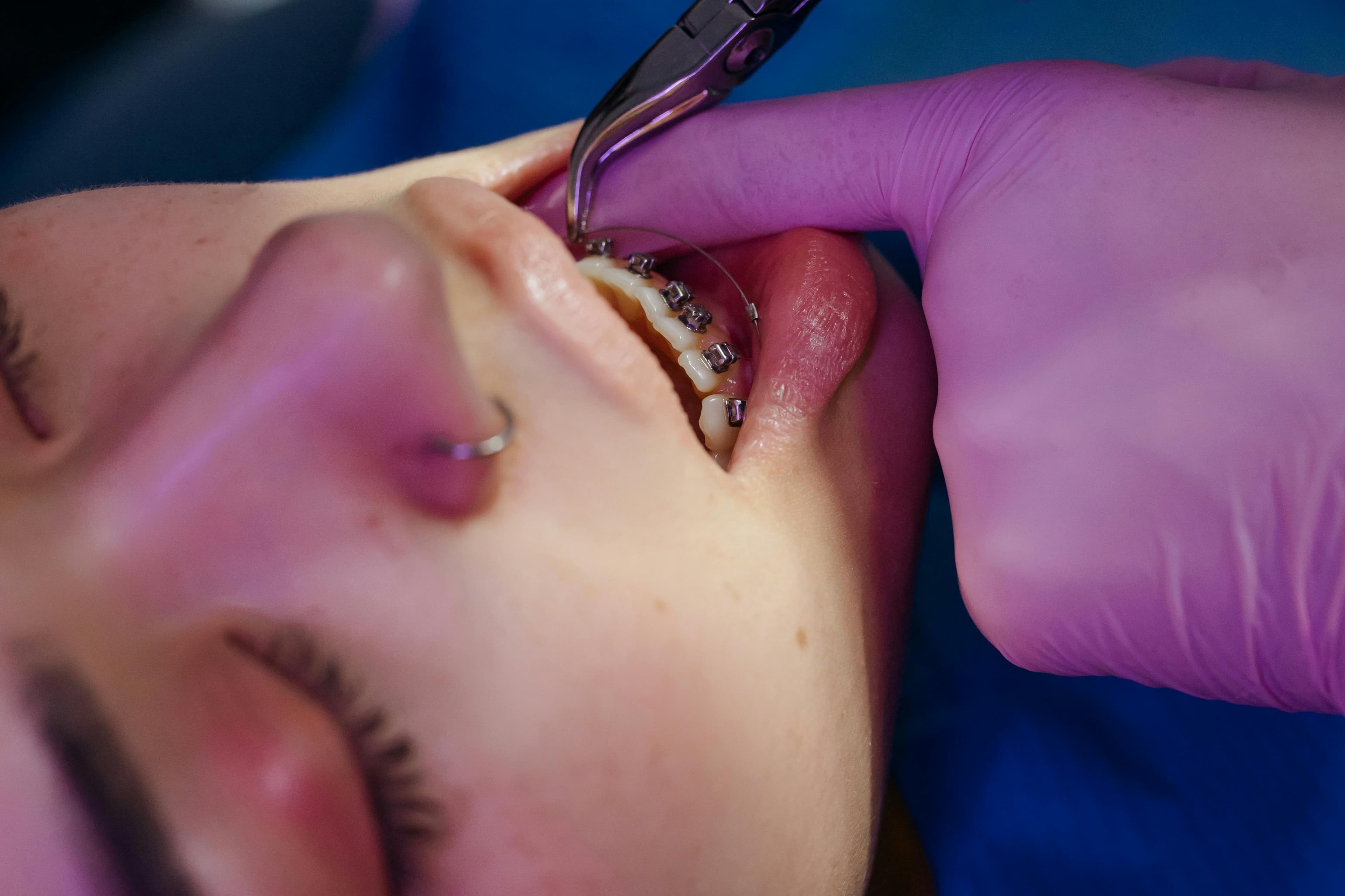 Orthodontic consultation at Worsthorne Dental Practice