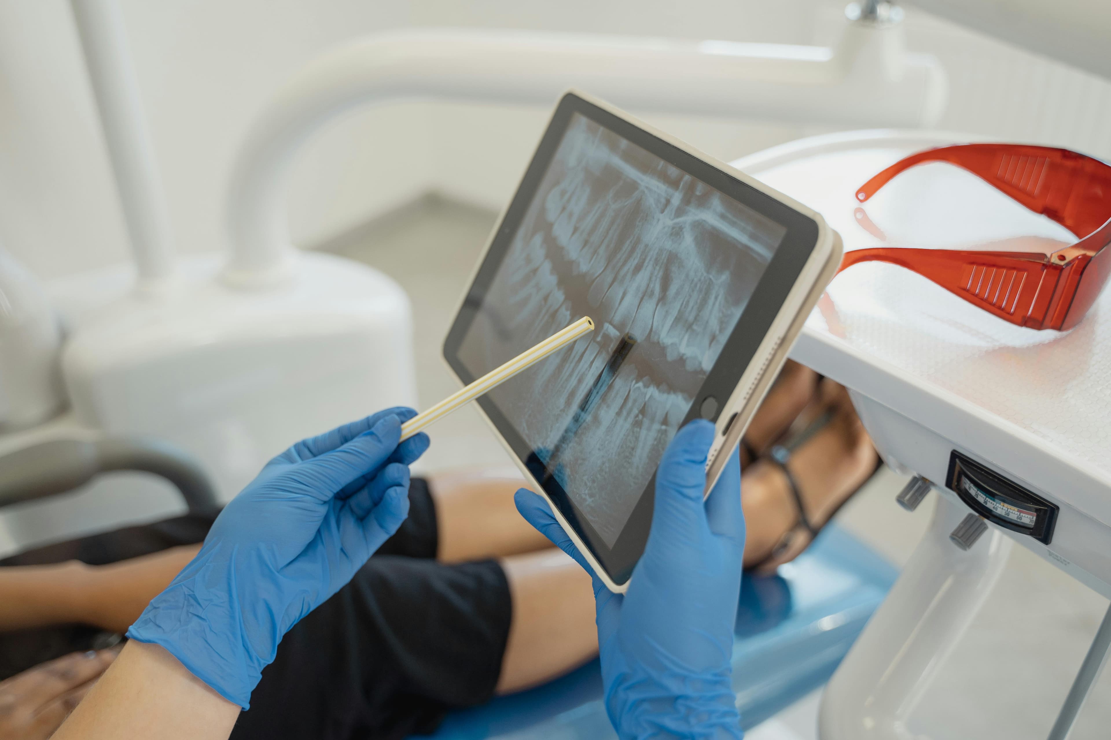 Root canal treatment at Worsthorne Dental Practice