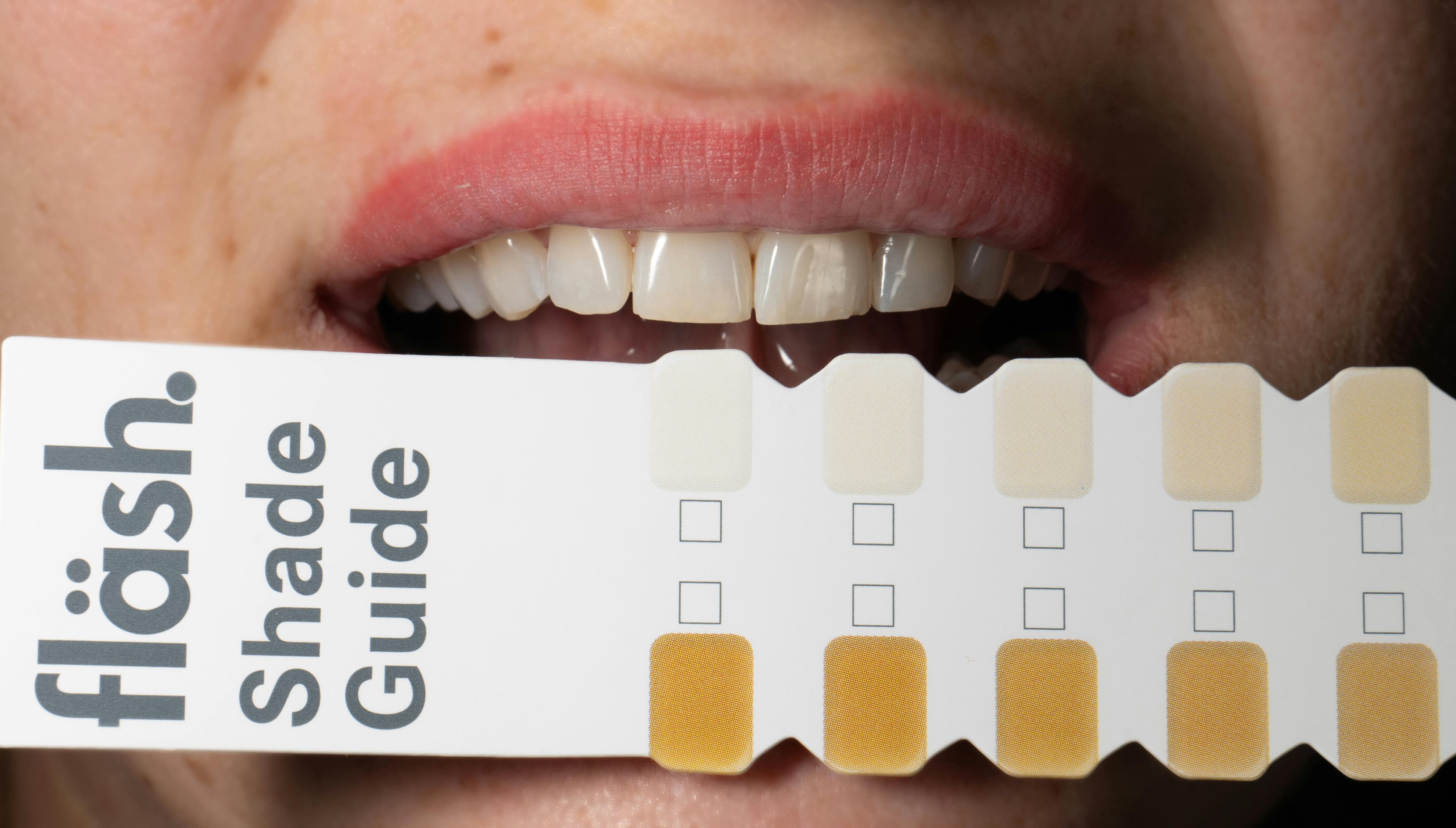 Teeth whitening consultation at Worsthorne Dental Practice
